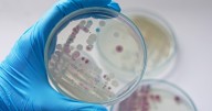 Cases of flesh-eating bacteria are on the rise. Here's why
