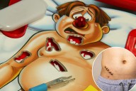 10 organs you can live without — one is 'largely useless'