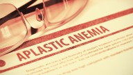Can Eltrombopag Transform Aplastic Anemia Care?