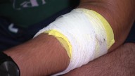 Random stabbing in Frisco neighborhood leaves teen injured