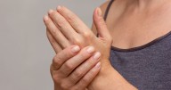 Signs in your hands could indicate a 'worrying' health condition