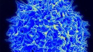 Una vacuna contra el cáncer pasa con éxito los primeros ensayos clínicos