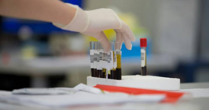 Cada cuánto tiempo deberías hacerte un análisis de sangre