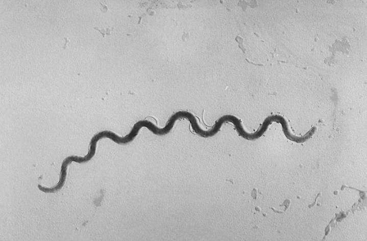 3 babies have died of congenital syphilis in New York: What is it?