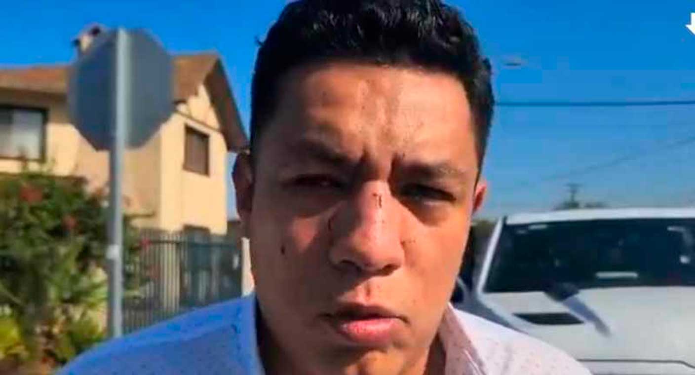 Agreden a golpes al periodista Jorge Heras en Mexicali; lo amenazan por su labor informativa