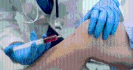 Este nuevo tejido mamífero podría ser la clave para regenerar el cartílago y tratar lesiones traumáticas