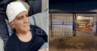 Brutal agresión al exboxeador salteño Héctor Hugo Vilte: buscan a dos jóvenes que lo golpearon hasta desmayarlo