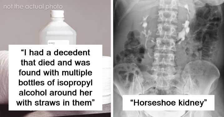 13 Forensic Scientists Share What Was Their Most Shocking Finding