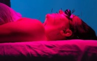 Video.- ¿Puede la acupuntura estética ser el nuevo bótox?