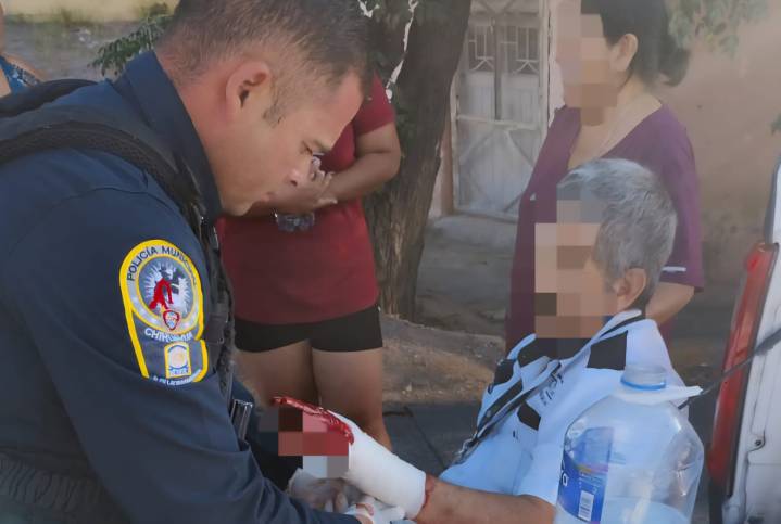 Policías municipales auxilian a ciudadano con hemorragia en un brazo