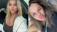 Woman shows dramatic way her nose totally changed shape before & during pregnancy & yells at mums for not warning her