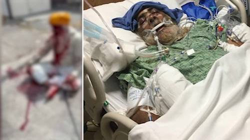 Sikh community rallies after Harpal Singh brutally beaten with golf club in North Hollywood attack