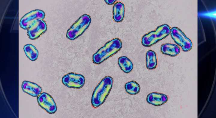 California resident tests positive for plague