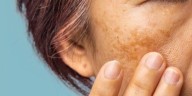 La planta que elimina paño negro e impurezas del rostro y cuello que es muy común, pero pocos saben sus beneficios