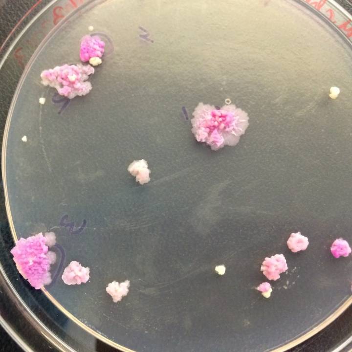 New study shows promise for better TB treatments, California researchers say