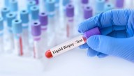¿Es posible una vacuna única contra el cáncer?: comprendiendo su complejidad