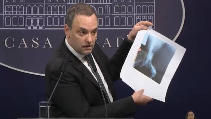 Manuel Adorni: veedor y propagador de fakes news