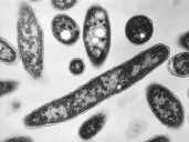 Récord de infecciones por "bacterias carnívoras" en Estados Unidos: ya hay 6 muertos y 34 infectados