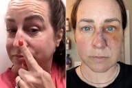 Mom Thought She Just Had Dry Skin Before Skin Cancer Diagnosis