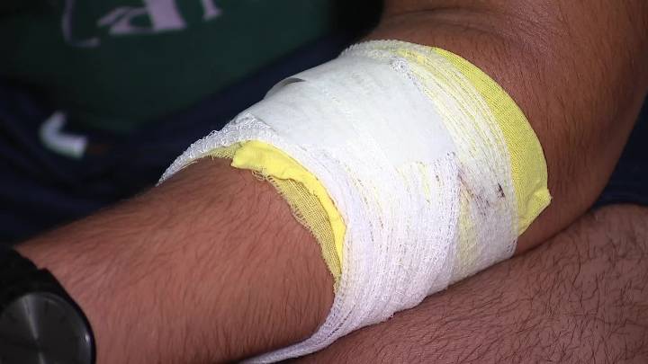 Random stabbing in Frisco neighborhood leaves teen injured