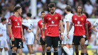 Insólito: Manchester United quede eliminado de la Copa de la Liga inglesa ante equipo de cuarta división