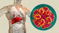 Medication Non-Adherence Common in Autoimmune Liver Diseases