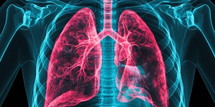 Cómo identificar los primeros síntomas de EPOC y por qué es clave no subestimarlos