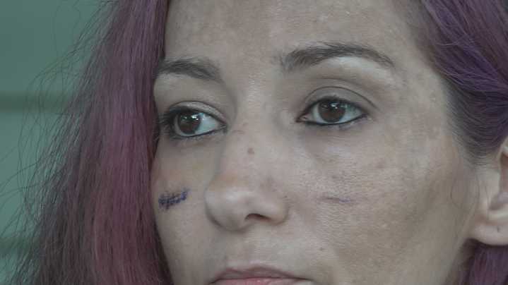 Victim of Pinellas Park home invasion shares her story of survival