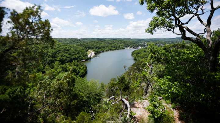 Case of brain-eating amoeba confirmed in Missouri, officials say