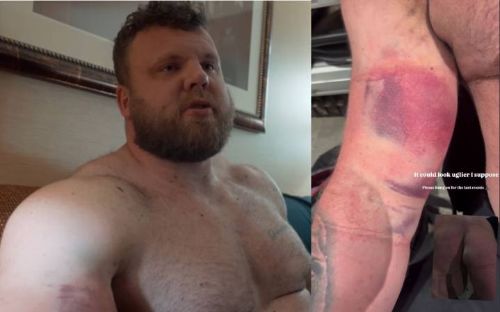 Tom Stoltman Reveals Bicep Injury Following an Eighth-Place Finish at 2025 Strongest Man On Earth – Fitness Volt