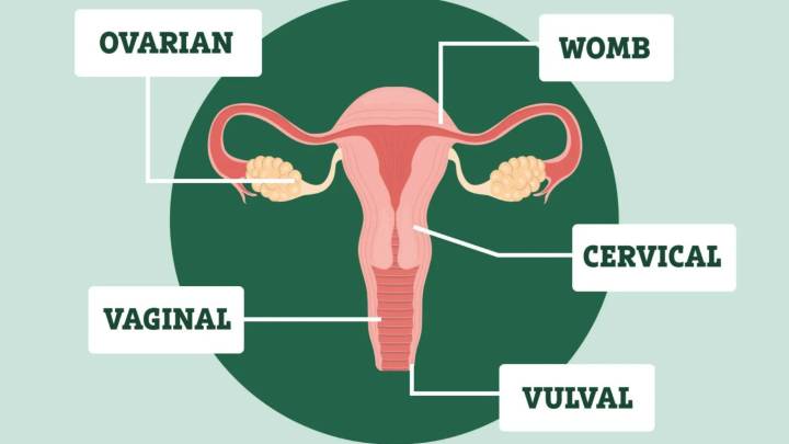 Do YOU know the ‘red-flag’ symptoms of 5 gynae cancers? Test your knowledge now – it might save your life