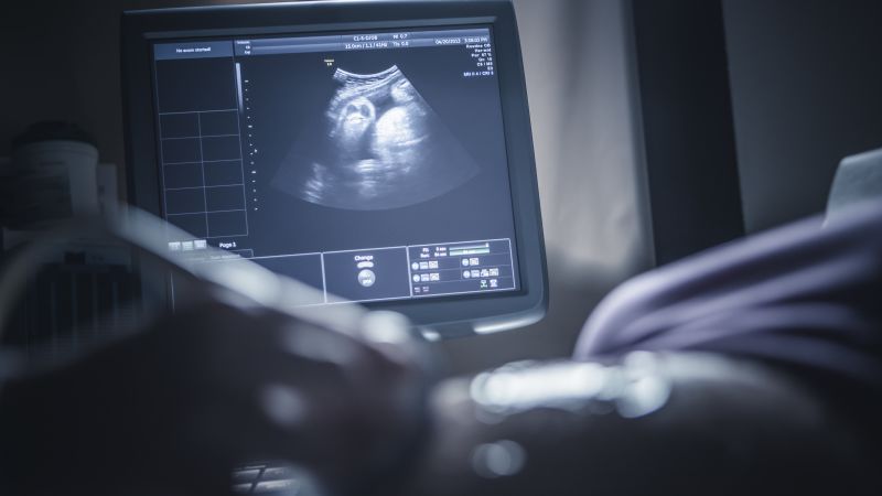 Another major medical association breaks from CDC as ob/gyn group recommends Covid