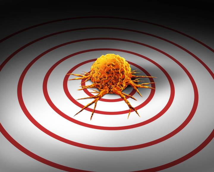 Exelixis: RCC Stronghold, NET Launch, And A CRC Readout That Matters (NASDAQ:EXEL)