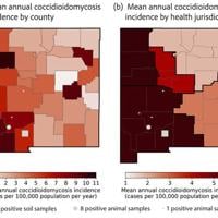 New Mexicans could be at higher risk of Valley fever, according to new Los Alamos study