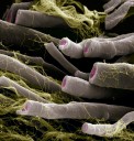 Out-of-balance bacteria is linked to multiple sclerosis − the ratio can predict severity of disease