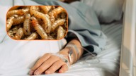 Contagios de gusano barrenador en humanos se extienden a Yucatán y Tabasco