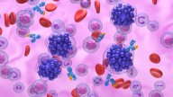 CAR T Excels in Second-Line Lymphoma Care