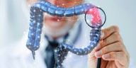 Guía sobre la colonoscopia: procedimiento, indicaciones y su papel en la prevención del cáncer colorrectal