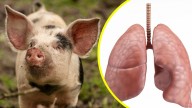 Es el primero en la historia: Trasplantan un pulmón de cerdo a un humano con muerte cerebral