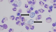 Brain-eating amoeba confirmed in Missouri: What to know about the dangerous organism