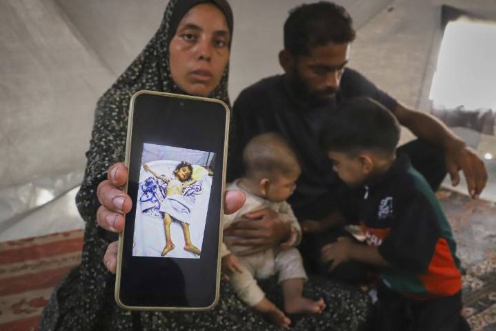 Se agrava la desnutrición en Gaza, aumenta el número de niños fallecidos