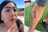 Heridos por caída de muelle acusan evasión de responsabilidad de restaurante en Valle de Guadalupe