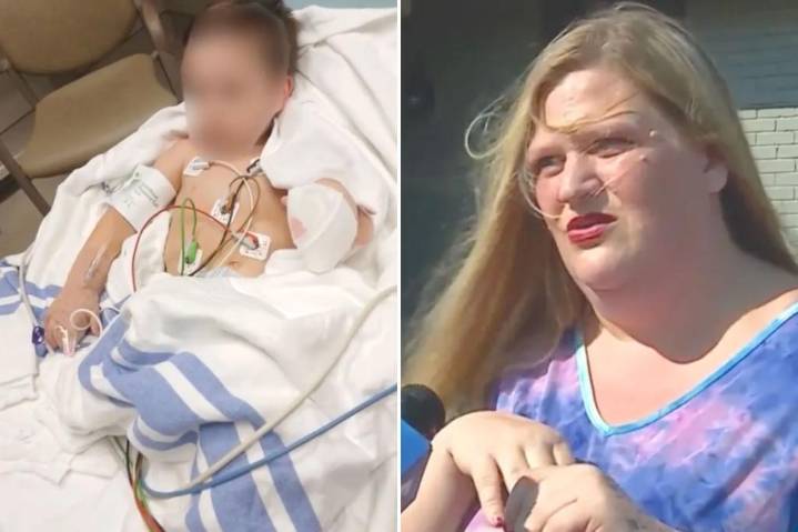Parents warned after toddler's finger severed in horrific tricycle accident