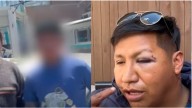 Adolescente desfigura a dueño de cevichería dentro de comisaría