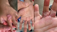 Queman manos a dos menores; padrastro y madre son detenidos