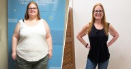 Duodenal Switch Weight Loss Surgery Helps Woman Lose 220 Pounds