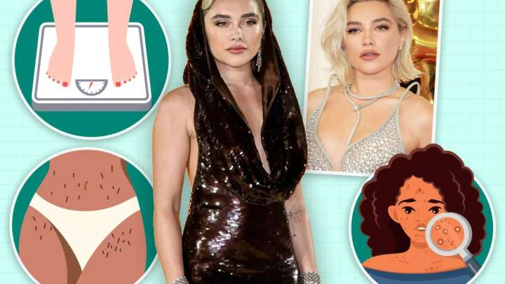 The 3 symptoms of actress Florence Pugh's condition she assumed were 'normal' until a DREAM prompted a check