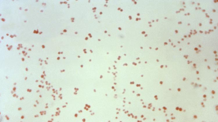 US STD rates drop, but syphilis in babies rise in 2024