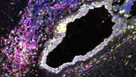 Immune System Can Be Reprogrammed to Heal Body Faster–Jump-Starting it via Electrical Stimulation