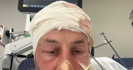 'I was diagnosed with two brain tumours after mistaking symptoms for something else'
